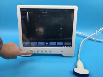 מרפאת 15 אינץ LCD נייד מחשב נייד מסך מגע אולטרסאונד
